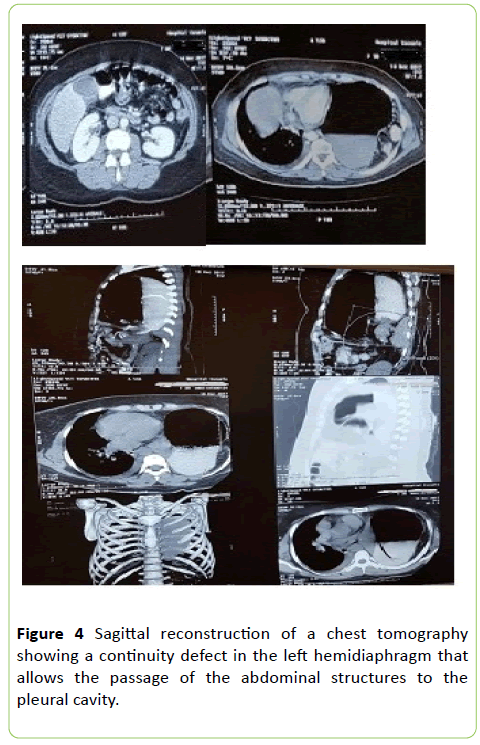 medical-clinical-chest-tomography=