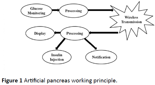 medical-clinical-reviews-Artificial-pancreas