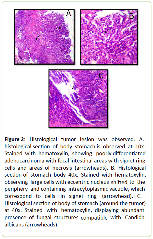 medical-clinical-reviews-Histological-tumor