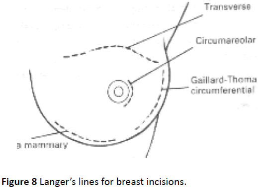 medical-clinical-reviews-breast-incisions