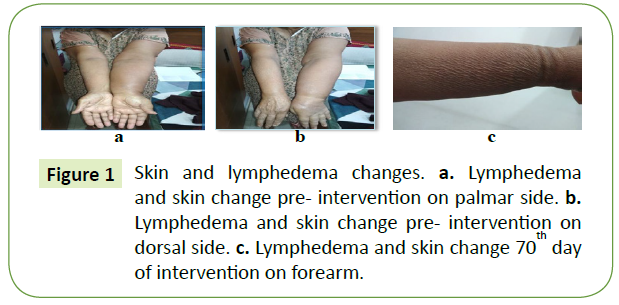 medical-clinical-reviews-lymphedema