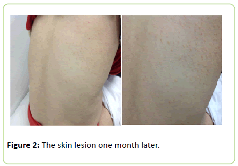 medical-clinical-reviews-skin-lesion