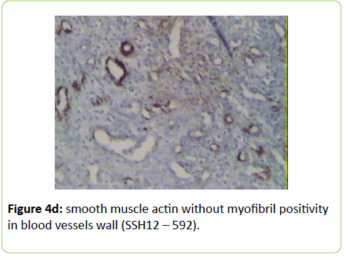 medical-clinical-smooth-muscle